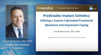 Predictable Implant Aesthetics Utilizing a Custom Fabricated Provisional Abutment & Impression Coping Webinar Thumbnail