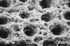 Fig 3. This SEM is basically the same as Fig 2 except the collagen seen in Fig 2 has been removed with collagenase enzymes exposing the dentin underneath that has not been, or has been minimally, demineralized by acidic pretreatment. It is this interface that is important to engage, via hybrid layer formation, to achieve good bonding and a well-sealed interface. (SEM courtesy of the late Dr. John Gwinnett.)