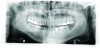 Panoramic radiograph from 2009.