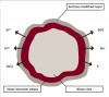 Figure 7  Giomer pre-reacted glass (PRG) technology.