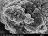 Figure 1  SEM image showing the combination of nano-clusters and nano-particles in the new resin nano-ceramic material.