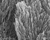 Figure 2  SEM micrograph of acid-etched enamel. The nanoparticle apatitic infrastructure is more apparent (x76500 magnification).