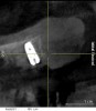 Figure 25  Postoperative CT scan demonstrated horizontal bone regeneration.