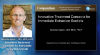 Innovative Treatment Concepts for Immediate Extraction Sockets Webinar Thumbnail