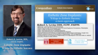 Esthetic Zone Implants: 8 Keys to Esthetic Success Webinar Thumbnail