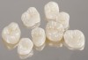 Fig 12. Posterior monolithic high-translucent zirconia onlay and crown restorations.