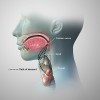 Fig 1. Depiction of pathway of the thyroid tissues from the foramen cecum of the tongue to the proper anatomical position showing the most frequent sites for development of a TGDC.