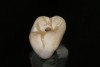 Fig 11. Thinned brown stain applied to the occlusal surface.