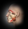 Fig 2. Masseter attachment trigger points of the lower superficial layer with referred pain patterns to lower jaw and above eyebrow.