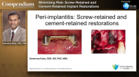 Minimizing Risk: Screw-Retained and Cement-Retained Implant Restorations Webinar Thumbnail