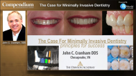The Case for Minimally Invasive Dentistry Webinar Thumbnail