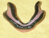 Fig 2. Mandibular custom tray border-molded with low-fusing compound (photograph courtesy of Carl Hansen, DDS).