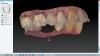 Fig 5. Final open system intraoral STL file.