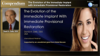 The Evolution of the Immediate Implant With Immediate Provisional Restoration Webinar Thumbnail