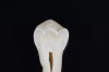 Fig 7. ICDAS code 0: Sectioned tooth confirms stain not indicative of carious penetration of fissure.