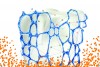 Fig 1 and Fig 2. Delmopinol hydrochloride interferes with biofilm matrix formation (Fig 1). The biofilm mass becomes loosely adherent and can be easily removed by the patient Fig 2. (Images courtesy of Sunstar Americas, Inc. Used with permission.)