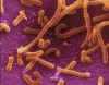 Fig 1. Lactobacillus is a non-pathogenic Gram-positive rod found in various dairy products.