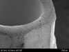 Fig 3. Glass-bead blasted abutment at 50X (Fig 3) and fit of the abutment in implant at 400X (Fig 4).