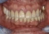 Fig 7. Existing dentition was sound periodontally and reasonably esthetic.