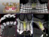 Fig 4. Planning software is shown. STL file of the maxillary arch has been imported from optical scanning and matched to regional anatomy for soft-tissue visualization. The aluminum fiduciary of the CT marker can be observed in the axial view. Virtual teeth have been constructed for Nos. 8 and 9, and the case has been planned for prosthetically directed implant placement on a dynamic navigation platform.