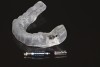CAD/CAM-milled surgical guide designed from CAD data and CBCT implant plan for guided implant placement.