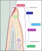 Fig 1. Soft tissue augmentation procedures are designed to maintain health, prevent recession, and provide comfort and esthetics. In this illustration, KT and non-keratinized tissue (alveolar mucosa) are delineated by the mucogingival junction. Note that attached gingival is the difference of KT and free gingiva (the gingival sulcus or periodontal pocket).