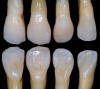 Fig 16. Lateral incisors: facial and lingual views.