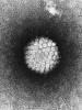 Fig 1. Electron micrograph of a negatively stained human 
papillomavirus. (This image is a work of the National Institutes of Health, part of the US Dept of Health and Human Services and, as a work of the US federal government, is in the public domain. https://commons.wikimedia.org/wiki/File:Papilloma_Virus_(HPV)_EM.jpg)