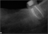 Fig 3. Tooth on an island.