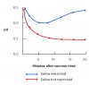 Fig 1. Comparison of the rebound of oral pH after exposure to a sucrose rinse in a patient with adequate salivary flow versus a patient with restricted salivary flow. Note that after 20 minutes, the pH of the patient with adequate salivary flow returns to baseline; in the patient with restricted salivary flow, the pH continues to drop after 20 minutes. (19)