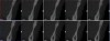 Fig 7. CBCT taken before SFOT treatment; note the lack of trabecular bone in the anterior mandibular region, suggesting a lack of available blood supply.