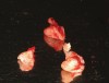 Fig 2. The tooth was sectioned to allow for extraction while enabling the surrounding bone of the socket to be maintained.