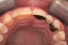 Fig 8. Palatal view.