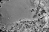 Fig 3. Pre- (Fig 2) and post-treatment (Fig 3) microscopic images of periodontal pocket plaque treated with plant-based silver nanoparticles. In a comparison of the two images, a notable reduction of pathogenic motile bacteria can be visualized in the sample after AgNP application (Fig 3).