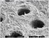 Fig 2. Dentin treated with 37% phosphoric acid for 15 seconds, rinsed, and blot dried. The smear layer has been removed and a thin zone of demineralization created. Collagen fibrils, which are inherent in dentin, are now exposed as they are no longer supported and surrounded by their inorganic hydroxyapatite scaffolding, which has essentially been “dissolved” away by the acid. It is important to penetrate this “collagen network” as completely as possible with subsequently placed primers and adhesives in order to achieve good bonding. (See Fig 3.)