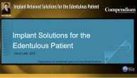 Implant Retained Solutions for the Edentulous Patient Webinar Thumbnail