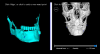 Fig 10. The practitioner can align separate stereolithographic files relative to a patient x-ray.