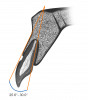 Fig 4. Tangent of available buccal bone relative to cingulum axis for screw retention.