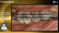 Faster and Better Dentistry, and Air Abrasion-Techniques That Will Build Your Practice Webinar Thumbnail