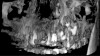 Fig 2. Frontal shaded surface rendering of the same patient shown in Fig 1. The threshold of the image has not been adjusted from the default value to allow for comparison.