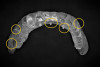 Fig 16. Scanning appliance. A copy of the patient’s mandibular denture was made from acrylic resin. The special CT glass beads (circled) can be seen.