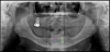 Fig 3. Panoramic radiograph.