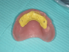 Fig 13. Indentations of abutments registered in the impression material.