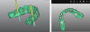 Fig 27. A CAD/CAM prosthesis was planned in the planning software (left); recesses permitted pickup of the denture attachment housings of the four anterior implants (right).