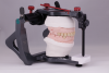 Fig 19. The final restorations on the articulator.