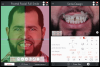 Fig 2. Screenshot of the smile design app. Facial parameters were analyzed, and the final 3D smile design was created.