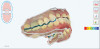 Fig 7. Scan from the lateral position showing overjet and overbite of teeth in relation to the preparations and the clearance needed for the final prosthesis.