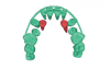 Fig 3. CBCT scans of palatal impacted canines; front view (Fig 2) and occlusal view (Fig 3).