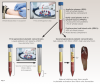 Fig 1. Clinical preparations for first- and second-generation platelet concentrates.