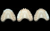 Fig 19. 3D-printed polymethylmethacrylate temporary shells with palatal supports.